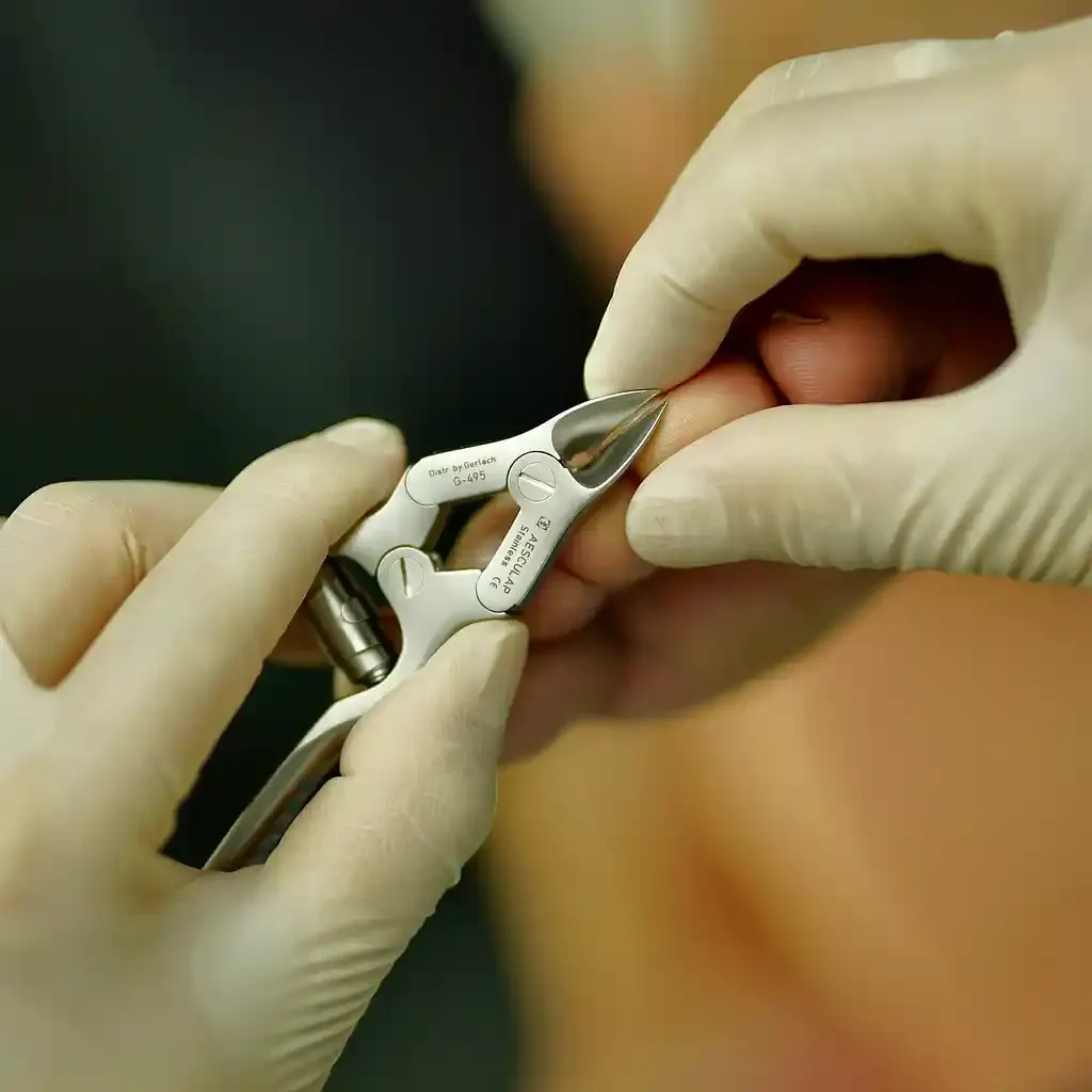 Routine foot care and nail trimming during a mobile foot care appointment.