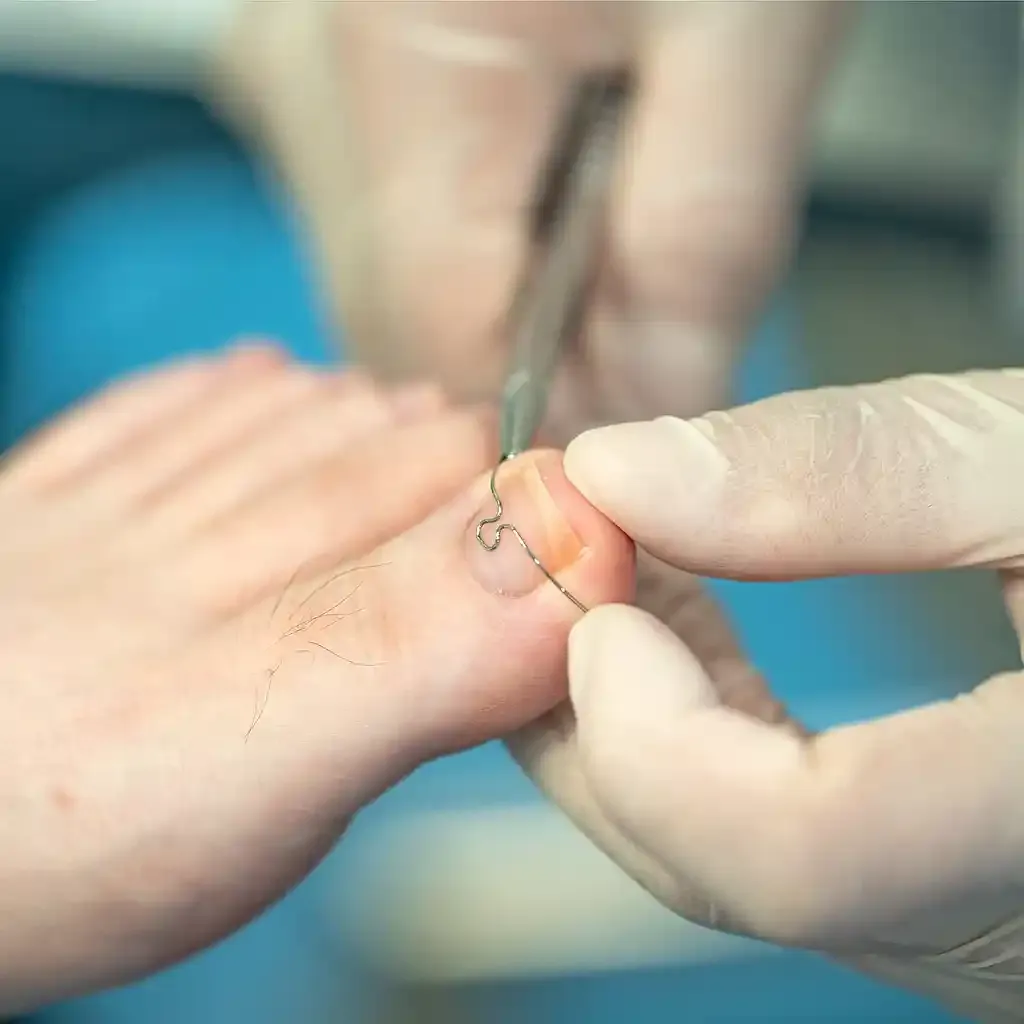 Clean and professional mobile foot care equipment set up for treatment.